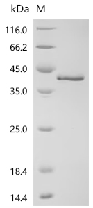 Recombinant Human Prickle-like protein 2 (PRICKLE2), partial