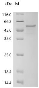 Recombinant Human Pancreatic lipase-related protein 3 (PNLIPRP3)