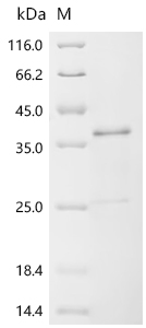 Recombinant Epstein-Barr virus Epstein-Barr nuclear antigen 2 (EBNA2), partial