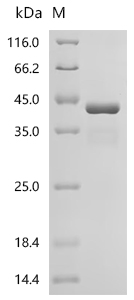 Recombinant Human Prickle-like protein 2 (PRICKLE2), partial