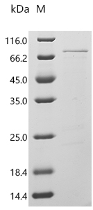 Recombinant Agaricus bisporus Polyphenol oxidase 3 (PPO3)