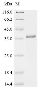 Recombinant Mouse Mannose-binding protein C (Mbl2)