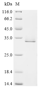 Recombinant Human YTH domain-containing family protein 2 (YTHDF2), partial