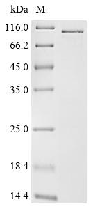 Recombinant Human Ribonucleoside-diphosphate reductase large subunit (RRM1)