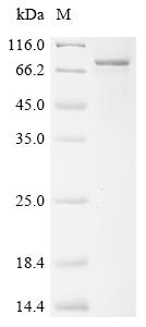 Recombinant Human E3 ubiquitin-protein ligase XIAP (XIAP) (1-1:M→MM)
