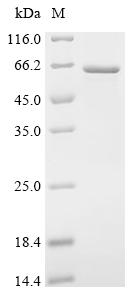 Recombinant Human Coronin-1A (CORO1A)