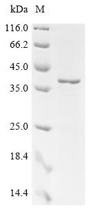 Recombinant Mouse IgG receptor FcRn large subunit p51 (Fcgrt), partial