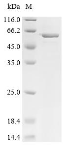 Recombinant Caenorhabditis elegans SAM domain-containing protein (bcc-1), partial