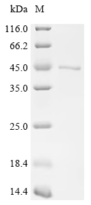 Recombinant Human E3 ubiquitin-protein ligase RBX1 (RBX1)