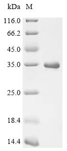 Recombinant Macaca mulatta Prostate-specific antigen (KLK3)