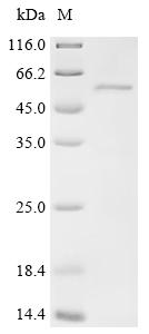 Recombinant Human Protein PRRC1 (PRRC1)