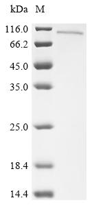 Recombinant Rat Protein kinase C-binding protein NELL1 (Nell1)