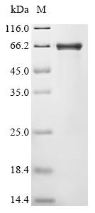 Recombinant Gorilla gorilla gorilla Tyrosine-protein kinase (LCK) (C476S)