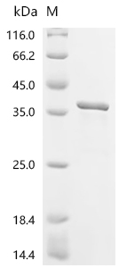 Recombinant Human PX domain-containing protein 1 (PXDC1)