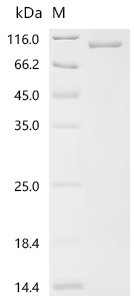 Recombinant Human Importin subunit beta-1 (KPNB1)