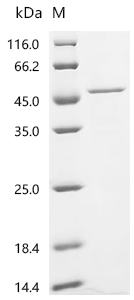 Recombinant Human Sialidase-2 (NEU2)