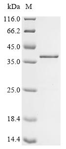 Recombinant Human Hepatoma-derived growth factor-related protein 3 (HDGFL3)