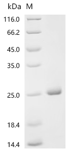 Recombinant Escherichia coli Putative anti-FlhC (2)FlhD (4) factor YdiV (ydiV)