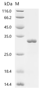 Recombinant Arabidopsis thaliana Transcription factor TCP21 (TCP21)