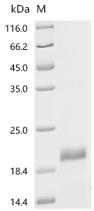 Recombinant Mouse Lymphocyte antigen 6D (Ly6d)
