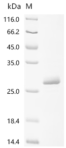 Recombinant Human immunodeficiency virus type 1 group M subtype G Protein Vpr (vpr)