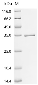 Recombinant Human Acetylcholine receptor subunit beta (CHRNB1), partial