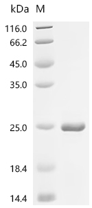 Recombinant Lupinus angustifolius Conglutin beta, partial