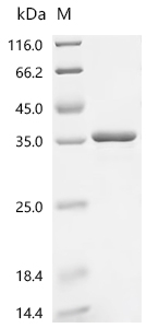 Recombinant Human 3 beta-hydroxysteroid dehydrogenase/Delta 5-->4-isomerase type 2 (HSD3B2), partial