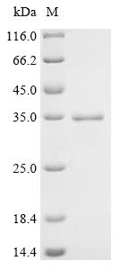 Recombinant Human Acetylcholine receptor subunit beta (CHRNB1), partial
