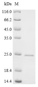 Recombinant Mouse Synaptic vesicle glycoprotein 2A (Sv2a), partial