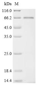 Recombinant Gorilla gorilla gorilla Tyrosine-protein kinase (LCK) (C378S)