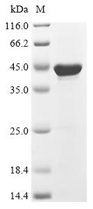 Recombinant Pan troglodytes TNC isoform 6, partial