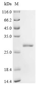 Recombinant Mouse COMM domain-containing protein 9 (Commd9)