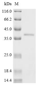 Recombinant Human immunodeficiency virus type 1 group M subtype G Protein Vpr (vpr)