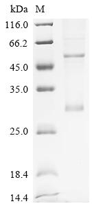 Recombinant Human Ras-related protein Rab-33A (RAB33A)