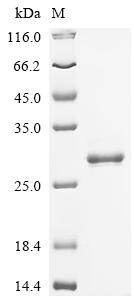 Recombinant Human Ras-related protein Rab-5C (RAB5C)
