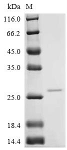 Recombinant Human Ras-related protein Rab-6B (RAB6B)