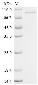Recombinant Mouse Netrin-1 (Ntn1)