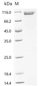 Recombinant Human Acetylcholinesterase (ACHE)