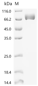 Recombinant Human Acetylcholinesterase (ACHE)
