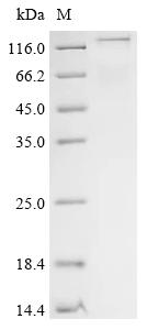 Recombinant Human Methyltransferase-like protein 17, mitochondrial (METTL17)