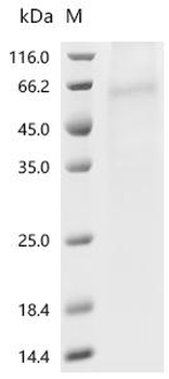 Recombinant Human 1-acylglycerol-3-phosphate O-acyltransferase PNPLA3 (PNPLA3)(I148M)