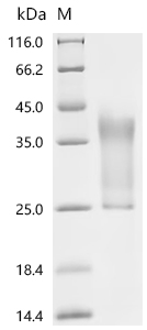 Recombinant Human Rap1 GTPase-activating protein 1 (RAP1GAP), partial