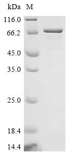 Recombinant Human Forkhead box protein C1 (FOXC1)