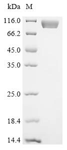 Recombinant Aspergillus fumigatus Protein ecm33 (ecm33)