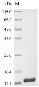 Recombinant Mouse Spectrin beta chain, non-erythrocytic 1 (Sptbn1), partial