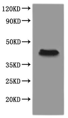 Recombinant Xenopus laevis Progestin and adipoQ receptor family member VIII L homeolog (paqr8.L)-VLPs