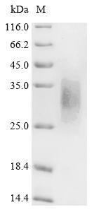 Recombinant Macaca fascicularis Parathyroid hormone/parathyroid hormone-related peptide receptor (PTH1R), partial