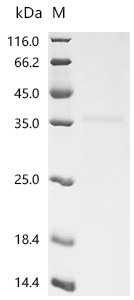Recombinant Human metapneumovirus Matrix protein (M)
