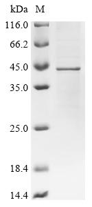 Recombinant Human Actin, cytoplasmic 1 (ACTB)